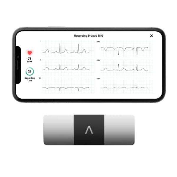 apparecchi diagnostici e di monitoraggio